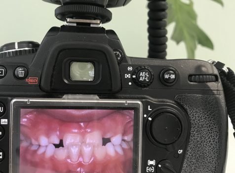 istanbul ortodonti tedavisi