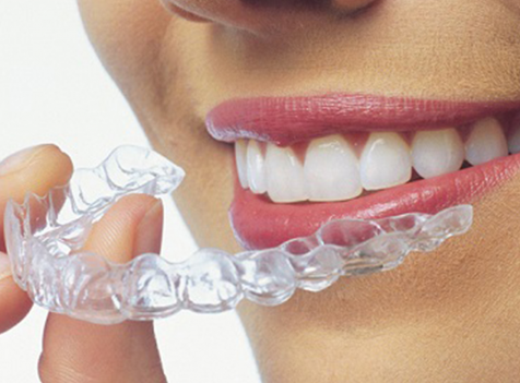 istanbul ortodontist invisalign