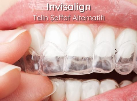 istanbul ortodontist şeffaf plak